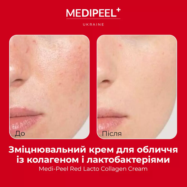 Укрепляющий крем для лица с коллагеном и лактобактериями Medi Peel Red Lacto Collagen Cream 50 гр 5201 фото