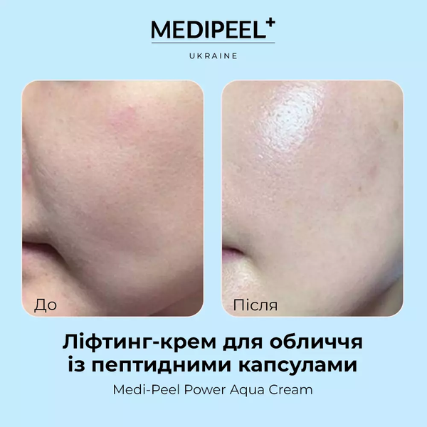 Ліфтинг-крем для обличчя із пептидними капсулами Medi-Peel Power Aqua Cream 50 мл 5202 фото