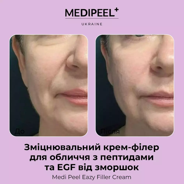 Укрепляющий крем-филлер для лица с пептидами и EGF от морщин Medi Peel Eazy Filler Cream 50 гр 5204 фото