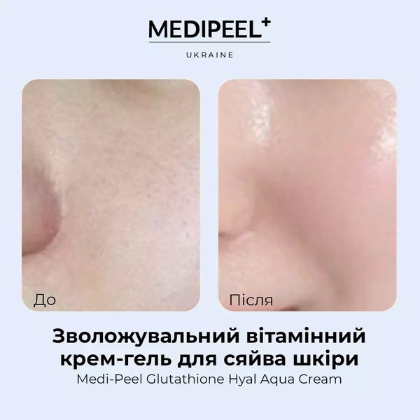 Увлажняющий витаминный крем-гель для сияния кожи Medi Peel Glutathione Hyal Aqua Cream 50 мл 5205 фото