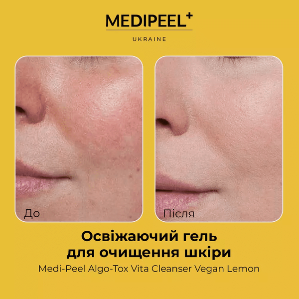 Освежающий гель для очищения кожи Medi Peel Algo-Tox Vita Cleanser Vegan Lemon 150 мл 5215 фото