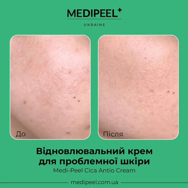 Восстанавливающий крем для проблемной кожи лица Medi-Peel Cica Antio Cream 30 мл 5216 фото