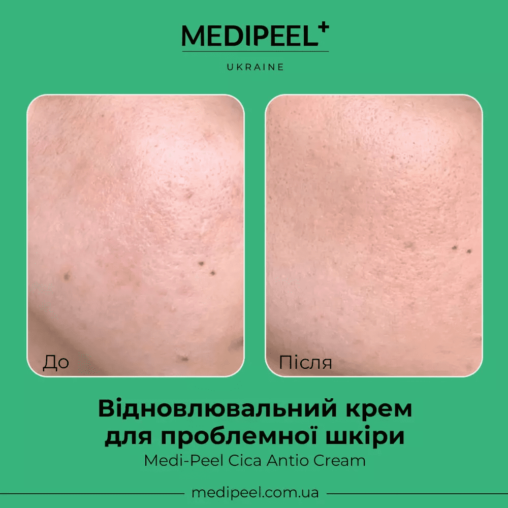 Восстанавливающий крем для проблемной кожи лица Medi-Peel Cica Antio Cream 30 мл